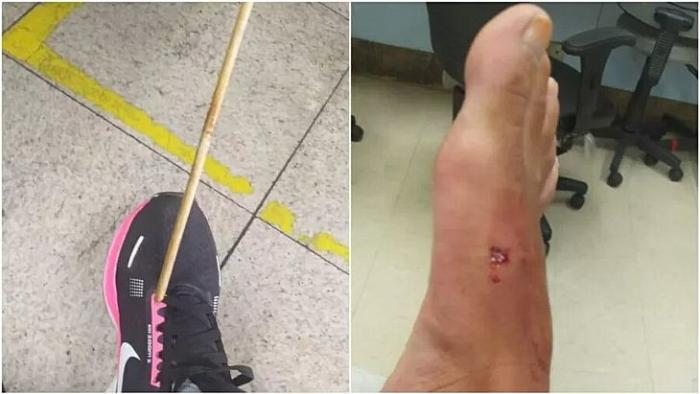 Mulher é ferida por flecha enquanto caminhava no centro de Belo Horizonte